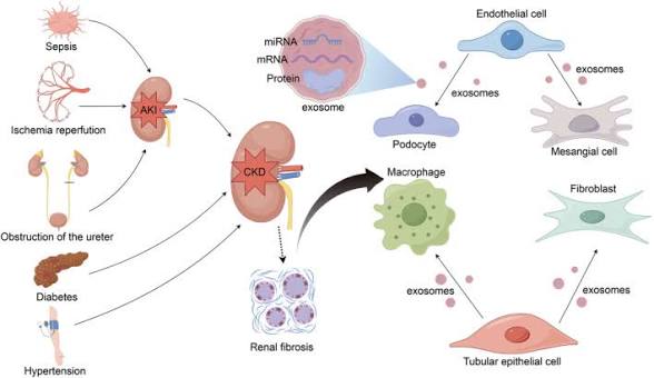 Exosome Therapy for Kidney Disease: The Next Frontier in Regenerative Medicine